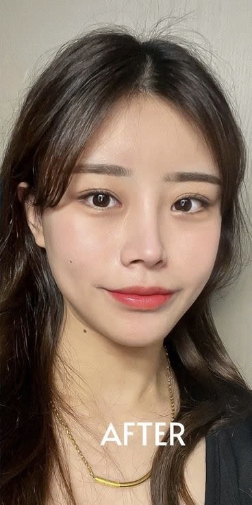 Trước